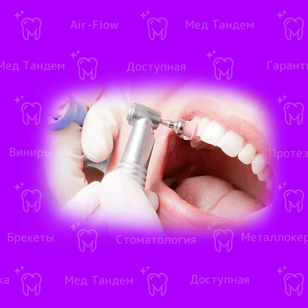 Акция на комплексную чистку зубов